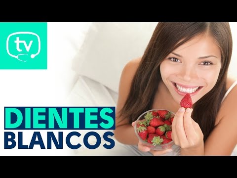 ¿Cómo mantener mis dientes más blancos?