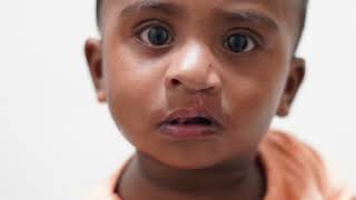 জন্মগত ঠোঁট ও তালু কাটা রোগীর সঠিক চিকিৎসা ও অপারেশন!