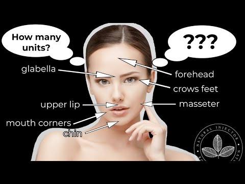 YouTube video about: How many units of dysport for first time?