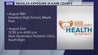 Measles case confirmed in Kane County, health department says