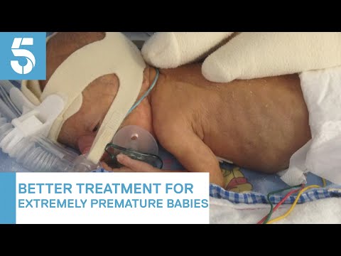 Doctors should try to save premature babies born after 22 weeks, medical leaders say | 5 News