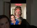 Dermatologist Reacts To Aggressive Chemical Peel For Acne Scarring #shorts #skincare |