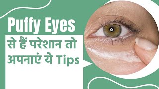 Easy Home Remedies For Puffy And Swollen Eyes