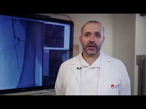 Embolizarea fibromului uterin