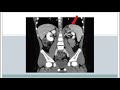 Robotic Partial Splenectomy Pediatric Tumor Of The Spleen Preserve Spleen Laparoscopic Seth Kipnis