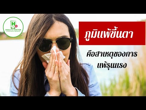Oxidate พรุในโรคสะเก็ดเงิน ความพิการที่มีฝ่าเท้าโรคสะเก็ดเงิน