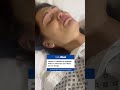 Singer Jessie J reveals she's been rushed to the hospital after breast cancer surgery