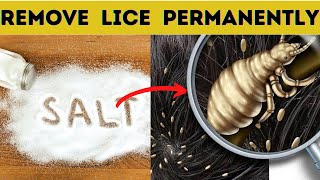 How  to  get  rid  of  head  lice  with  salt  permanently