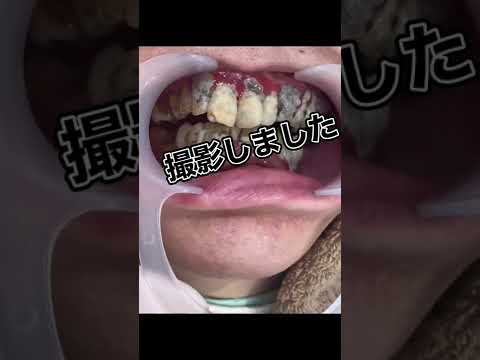 犬の歯をきれいにするさまざまな方法