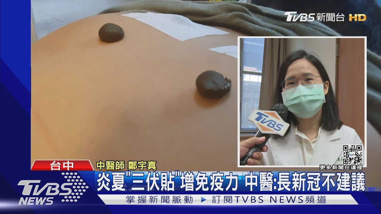 炎夏「三伏貼」增免疫力　中醫：長新冠不建議