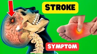 9 Warning Signs of Stroke - Shocking Symptoms