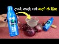 Onion Juice के साथ Nariyal Tel को Hair Growth के लिए लगाती हू�