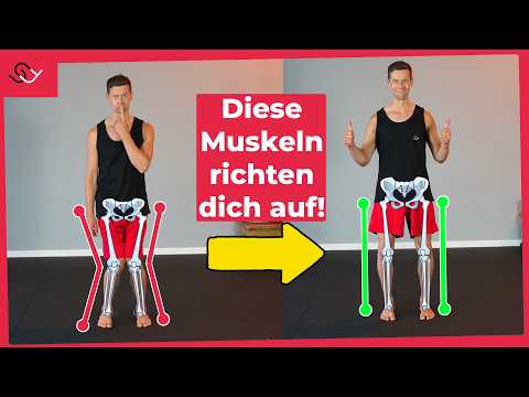 X-Beine loswerden - Mit diesen 2 Übungen