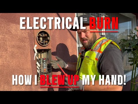 I Could've DIED! | Electrical Panel Upgrade Arc Flash Accident