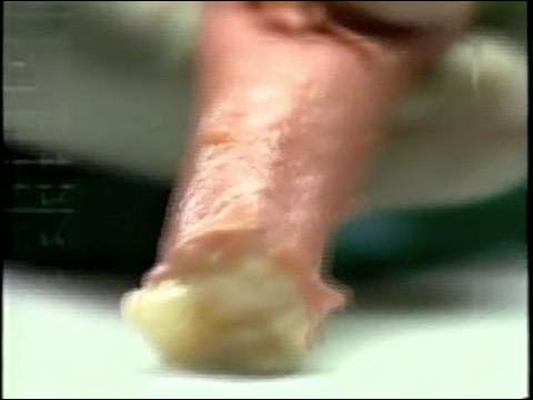 Anti-smoking groups want to gross you out