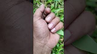 😱Itchy Caterpillar #caterpillar #insects #viralinsect #anyuniqueanimals