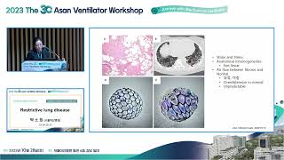 The 30th Asan Ventilator Workshop : Restrictive lung disease 미리보기