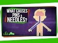 What Causes Pins and Needles?