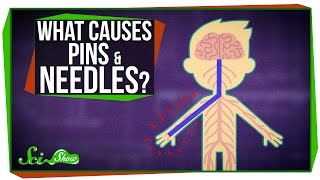 What Causes Pins and Needles?