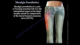 Meralgia Paresthetica - Everything You Need To Know - Dr. Nabil Ebraheim