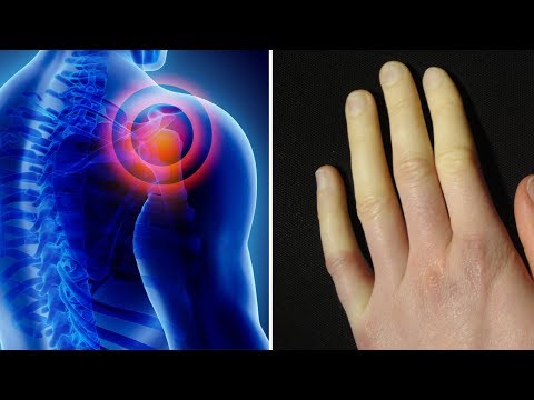 Sclerosis des Gelenkes, die es ein Foto ist Schmerzen im unteren Rücken als Schmerzen zu lindern