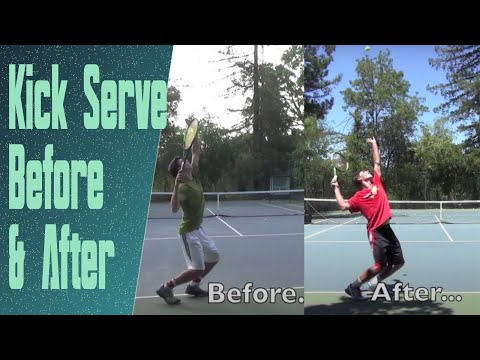 Kick Serve Advice & Progression (Featuring a High Ranked Junior)