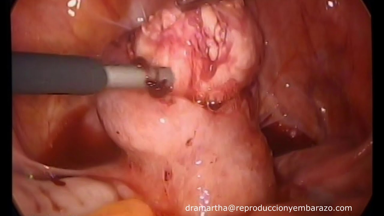 Jorge Alberto Rodriguez Pezino-61