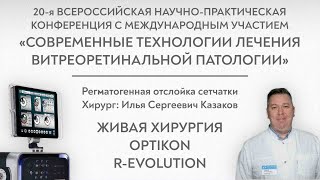 R-Evolution CR (Optikon 2000, Италия), живая хирургия, Казаков И.С.