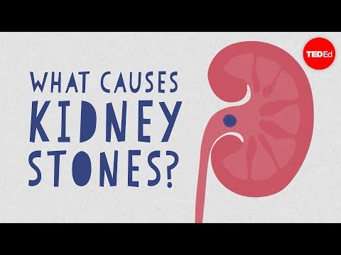 What Are the Root Causes of Kidney Stones?