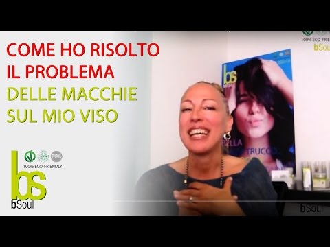 Pigmentazione su pelle e Posti di pigmentary dopo trattamento di abbronzatura