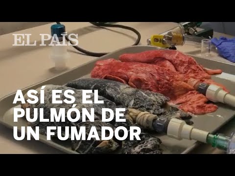 Así se transforma el pulmón de un fumador