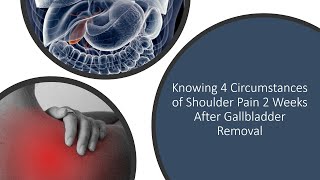 Knowing 4 Circumstances of Shoulder Pain 2 Weeks After Gallbladder Removal