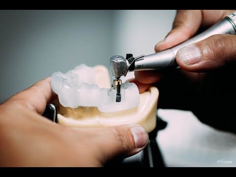 Hiossen Implant Canada - OneGuide Kit