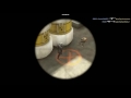 Silvers Life Is Hard