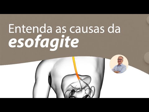Entenda as causas da esofagite | Prof. Dr. Luiz Carneiro CRM 22761