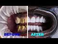 Check Out This Amazing Transformation 100 Porcelain