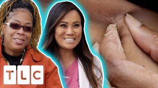 Woman Gets Bump Under Her Breast Removed FOR THE THIRD TIME | Dr. Pimple Popper