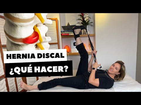 HERNIA DISCAL ¿QUÉ HACER?