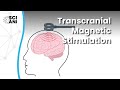 What Is Transcranial Magnetic Stimulation And How Can It Help Me