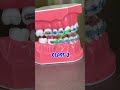 COMMON WAYS TO WEAR RUBBER BANDS WITH BRACES 🦷 ORTHODONTIST EXPLAINS