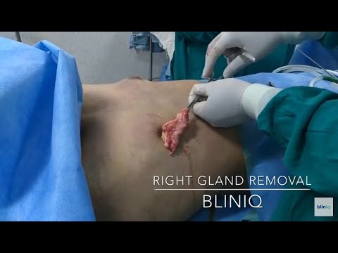 Patient Recovery Case — Video 19 (Facial Aesthetics)