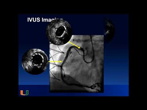 MY BEST SAVE OF THE YEAR - Mauricio Cohen, MD