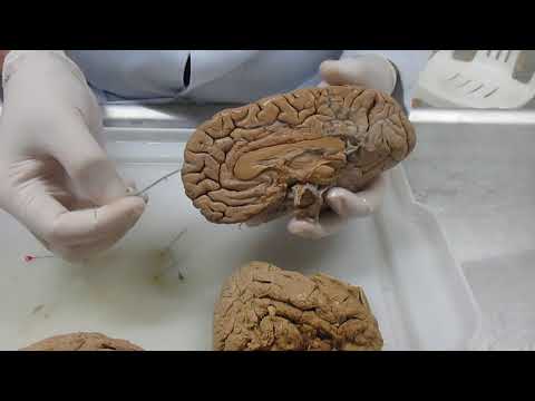 Morfologia Externa do Telencéfalo