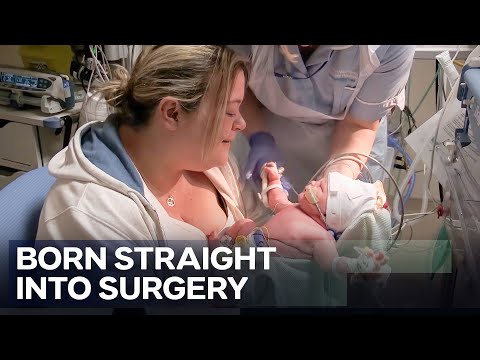 Born With Organs on the Outside: High-Risk Delivery | Midwives