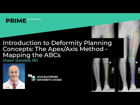 Introduction to Deformity Planning Concepts: The Apex/Axis Method - Shawn Standard, MD