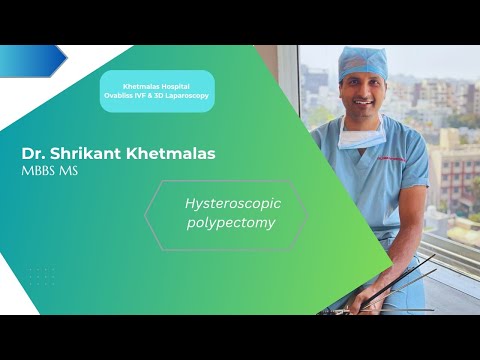 Large hysteroscopic uterine polyp excision | Dr. Shrikant Khetmalas