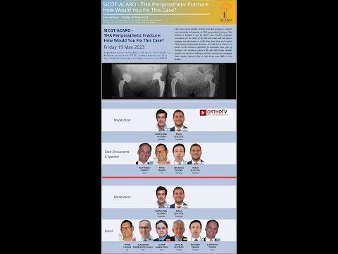 SICOT-ACARO - THA Periprosthetic Fracture: How Would You Fix This Case?