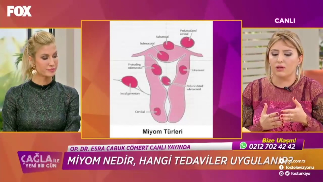 Esra Çabuk Cömert-31