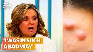 Woman left with boils on face after dodgy anti-wrinkle injections