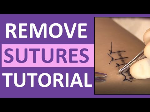 Suture Removal Nursing Skill | How to Remove Surgical Sutures (Stitches)
